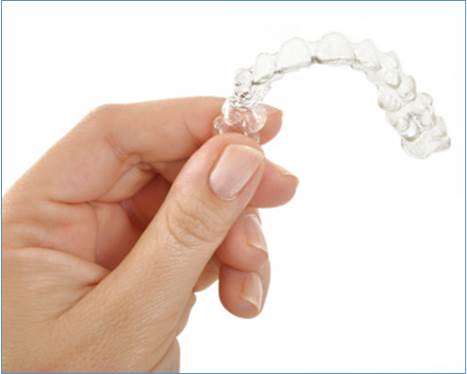 invisible braces