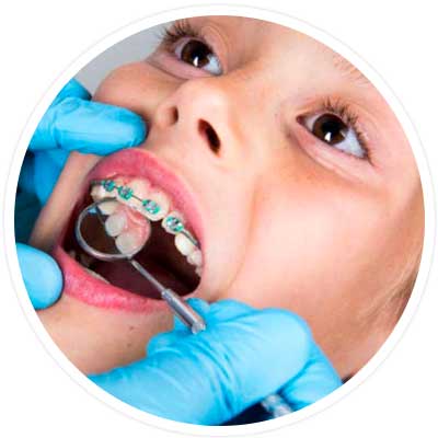 Image shows child getting preventative braces and having an orthodontic exam.