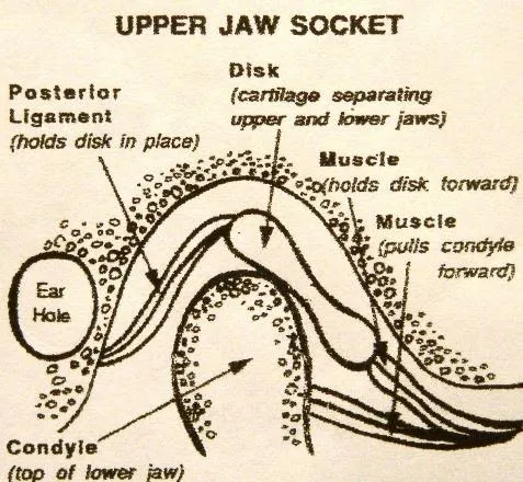 upper-jaw-socket