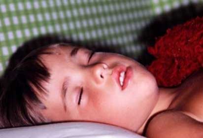 Child sleeping and breathing through mouth.