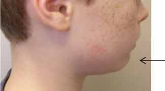 facial-profiling3