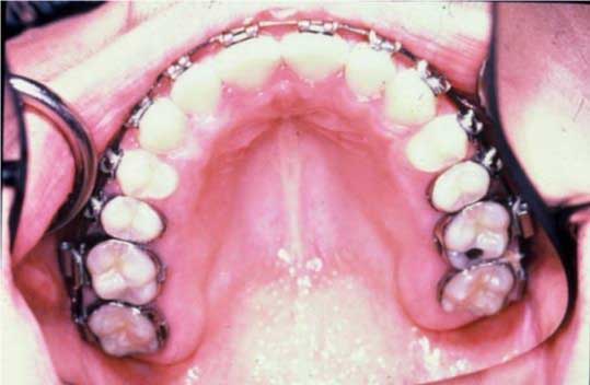 a more ideal shape and form of teeth