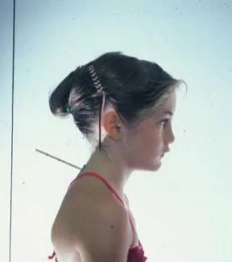 forward-head-posture