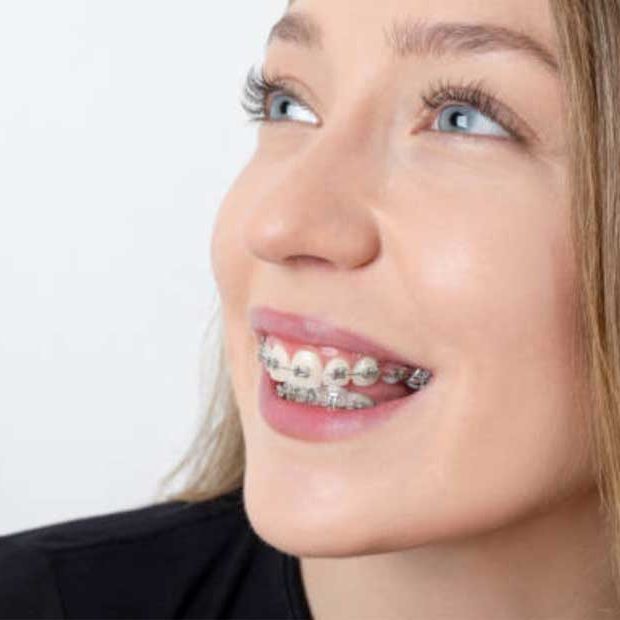 smiling girl wearing braces on her teeth